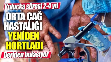 GÖRÜLMEYE BAŞLANDI DİKKAT